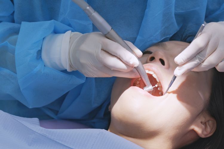tratamieto sarro dental